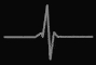 Pulse.gif